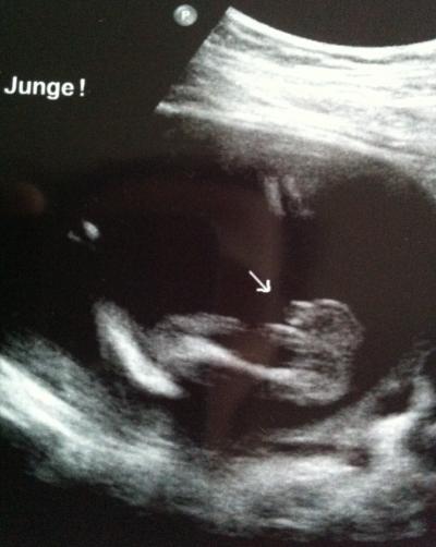 Bild zu FA bericht + Outing :) - Forum für Juli - Mamis