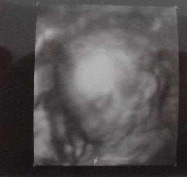 Bild zu Zurück vom FA :-) - Forum für Juli - Mamis