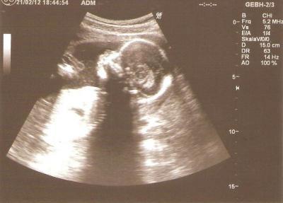 Bild zu US Foto - Forum für Juli - Mamis