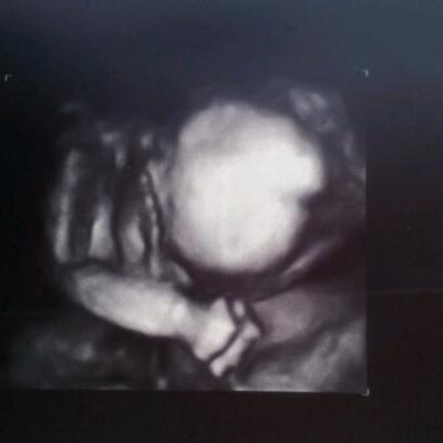 Bild zu Arztbericht u Fotos :-) - Forum für Juli - Mamis