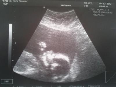 Bild zu Foto von gestern - Forum für Juli - Mamis