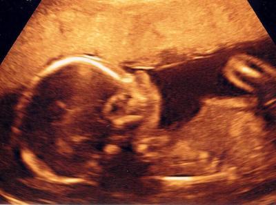 Bild zu Darf ich euch vorstellen... - Forum für Juli - Mamis