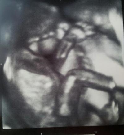 Bild zu überraschender 3d Ultraschall :-) - Forum für Juli - Mamis