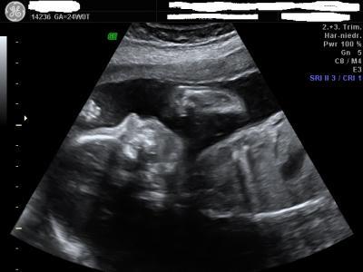 Bild zu Unser kleiner - Forum für Juli - Mamis