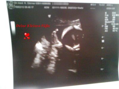 Bild zu zeigt her eure krümel und bäuchlein =) - Forum für Juli - Mamis