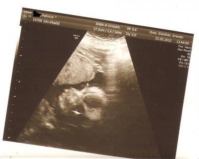 Bild zu ♥auch zurück vom FA&♥ - Forum für Juli - Mamis