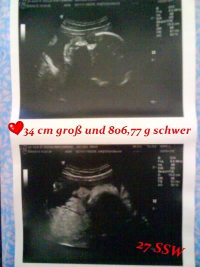 Bild zu FA bericht mit bilder vom mäuschen =) - Forum für Juli - Mamis