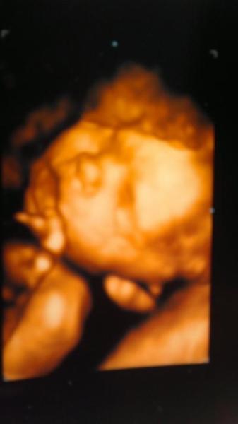 Bild zu 3d ultraschall:-) - Forum für Juli - Mamis
