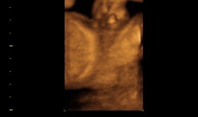 Bild zu Hier mal 3D-Fotos von mir ;-) - Forum für Juli - Mamis