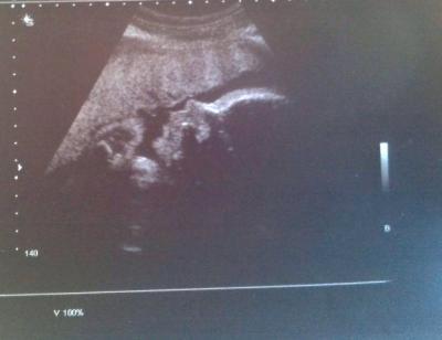 Bild zu zurück vom letzten "großen" Ultraschal - Forum für Juli - Mamis