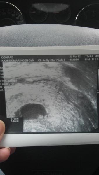 Bild zu Zurück aus dem KKH - Forum für Juli - Mamis