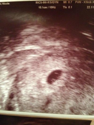 Bild zu 5 plus 6 ssw, US gehabt... Suche Vergleichswerte, Infos von allen lieben hier. - Forum für Juli - Mamis