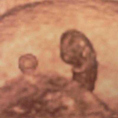 Bild zu 3D-Bild - Forum für Juli - Mamis