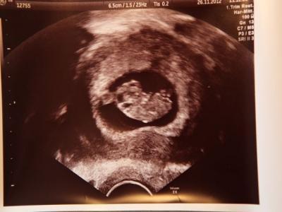 Bild zu Neues Baby-Bildchen - Forum für Juli - Mamis