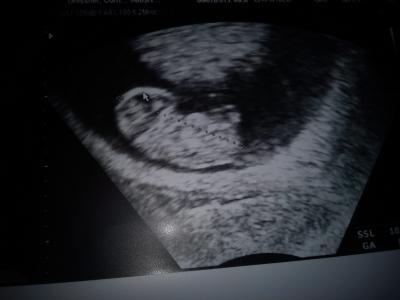 Bild zu Baby-TV Bilder nachreich - Forum für Juli - Mamis