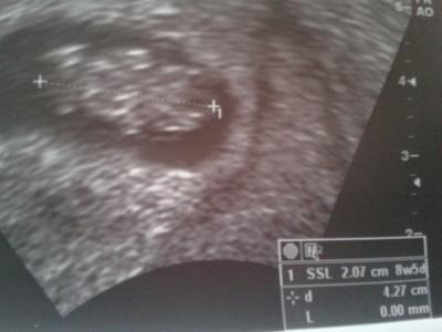 Bild zu War beim Frauenarzt, neues Foto ;-) - Forum für Juli - Mamis