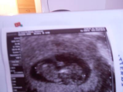 Bild zu musste zum Arzt........ - Forum für Juli - Mamis