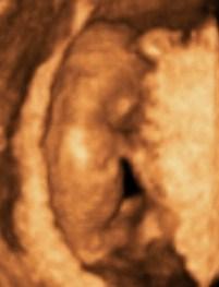 Bild zu Nadischa, da können wir einschlagen!!! - Forum für Juli - Mamis