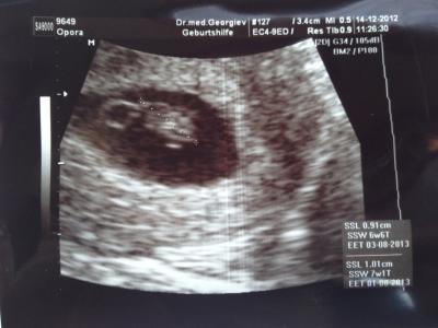 Bild zu zurück vom fa jaaaaa!! :) - Forum für Juli - Mamis