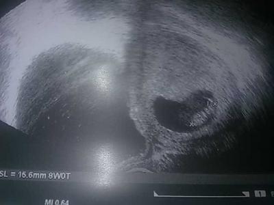 Bild zu Ultraschall im Krankenhaus - Forum für Juli - Mamis