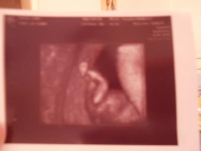 Bild zu FA bericht....13.SSW ...4.Monat :))) - Forum für Juli - Mamis