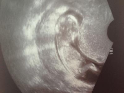 Bild zu Besuch beim FA - Forum für Juli - Mamis