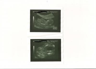 Bild zu Test US-Bilder - Forum für Juli - Mamis