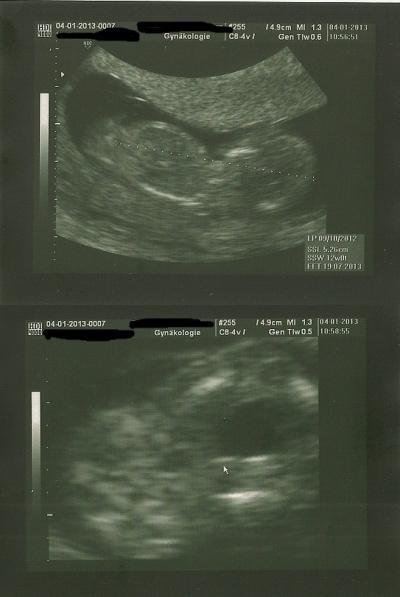 Bild zu 2 Versuch - Forum für Juli - Mamis