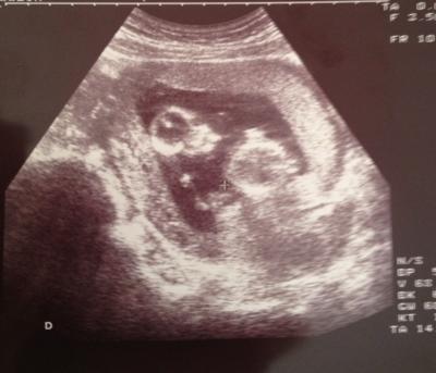 Bild zu Auch zurück vom FA!!! - Forum für Juli - Mamis