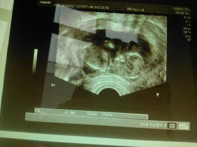 Bild zu FA Termin vom 18.01.13 - Forum für Juli - Mamis
