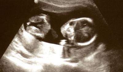 Bild zu Auch mal wieder Bild zeigen mag ;-) - Forum für Juli - Mamis