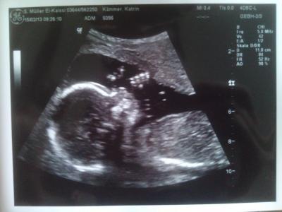 Bild zu Guckt mal unser Krümel... :) und Biene :) - Forum für Juli - Mamis