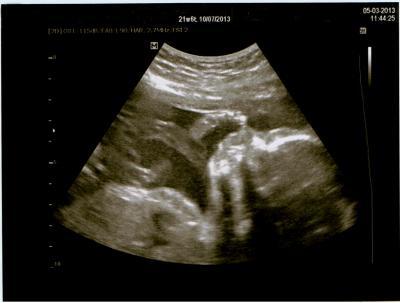 Bild zu Großer US und Outing... - Forum für Juli - Mamis
