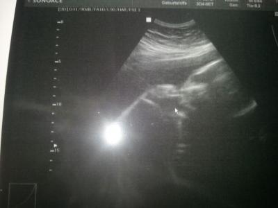 Bild zu Zurück vom FA:) - Forum für Juli - Mamis