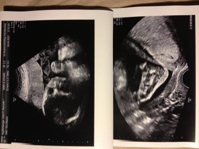 Bild zu 3. großer Ultraschall - Forum für Juli - Mamis