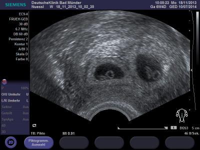 Bild zu ewig nicht mehr gemeldet - Forum für Juli - Mamis