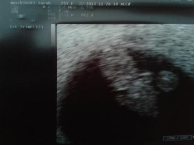 Bild zu Termin und Foto - Forum für Juli - Mamis