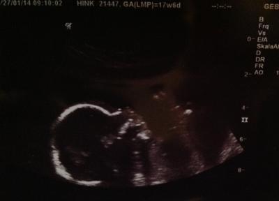 Bild zu Bin vom FA zurück ;-) - Forum für Juli - Mamis