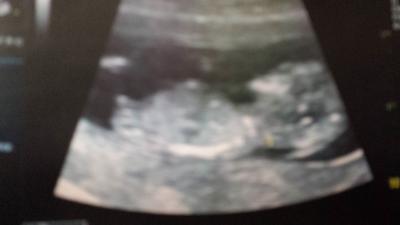 Bild zu Wer möchte einen Tip abgeben? - Forum für Juli - Mamis