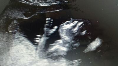 Bild zu Glücklichste Mama - Forum für Juli - Mamis