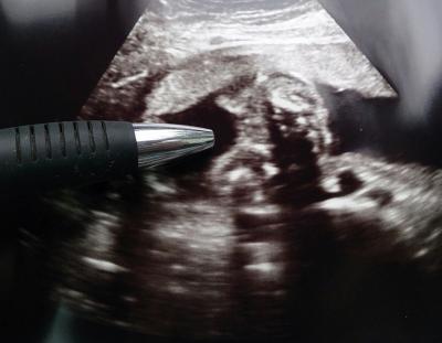 Bild zu Geschlecht - Forum für Juli - Mamis