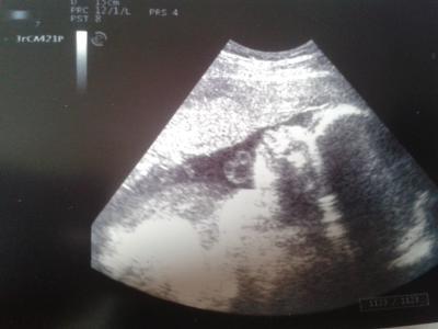 Bild zu fa-Bericht und Foto - Forum für Juli - Mamis