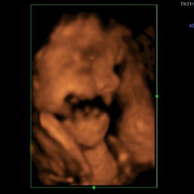 Bild zu heute beim FA gewesen!!! :) +Foto - Forum für Juli - Mamis