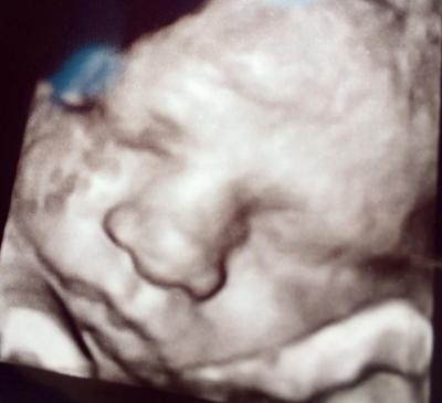 Bild zu Mein kleiner Mann :-) - Forum für Juli - Mamis