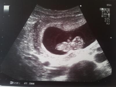 Bild zu mein erstes Bild! - Forum für Juli - Mamis