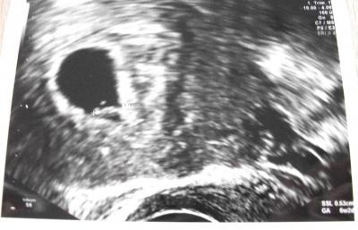 Bild zu US-Bildchen - Forum für Juli - Mamis
