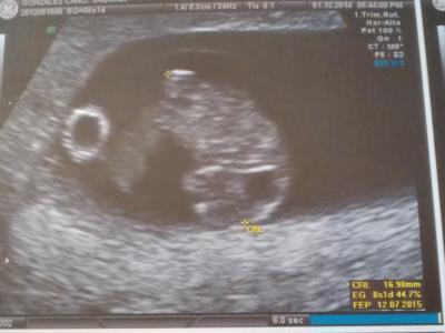 Bild zu 4mm in 5 Tagen :) - Forum für Juli - Mamis