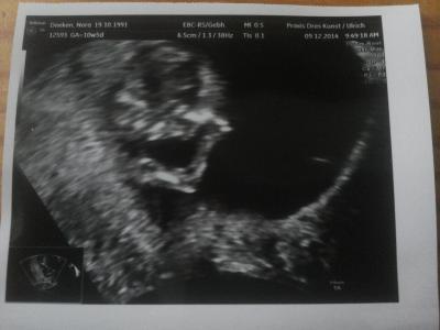 Bild zu 2. F.A. Termin =) - Forum für Juli - Mamis
