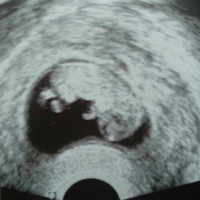 Bild zu Wieder zurück und FA geschafft - Forum für Juli - Mamis