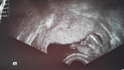 Bild zu Aktuelles - Forum für Juli - Mamis